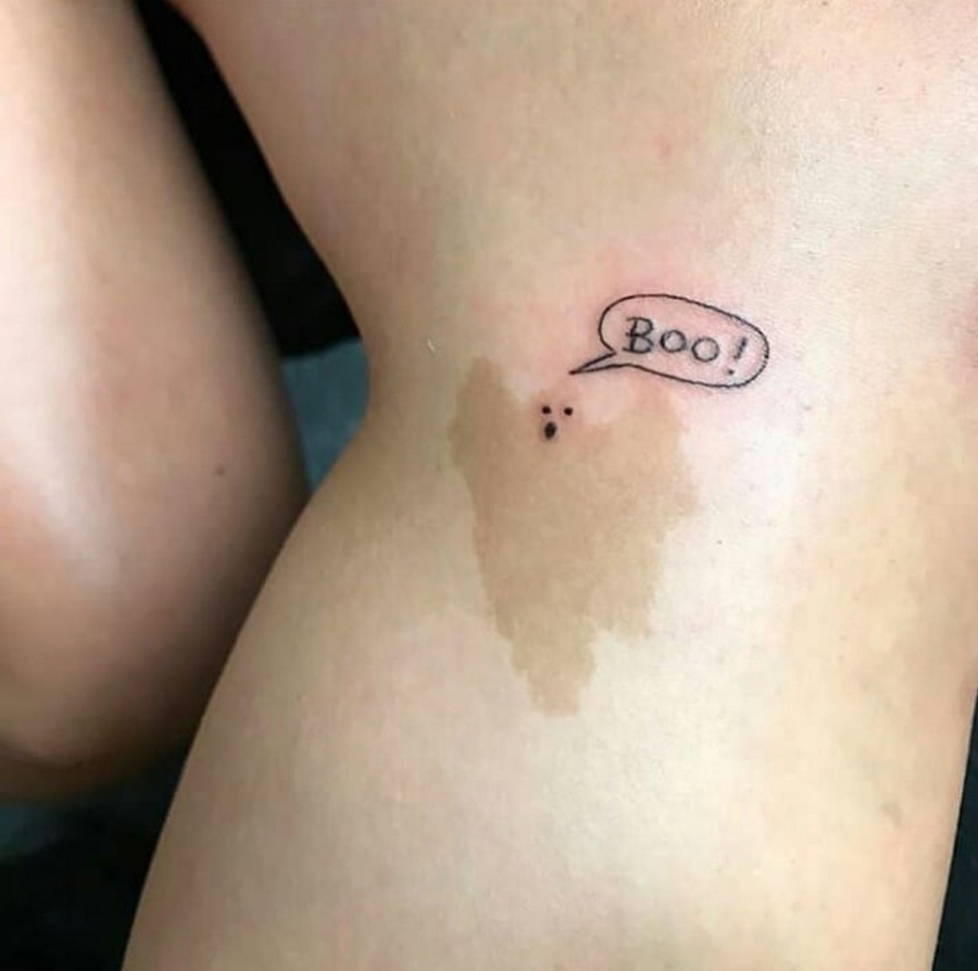 Scars-And-Birthmarks-Tattoo-Cover-ups