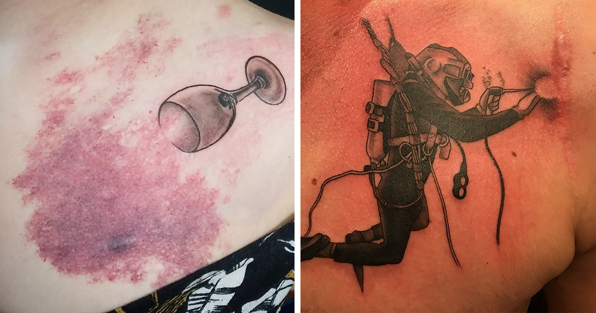 25 Times Tattoo Artists Nailed Covering Up People's Scars And Birth Marks – Architecture & Design